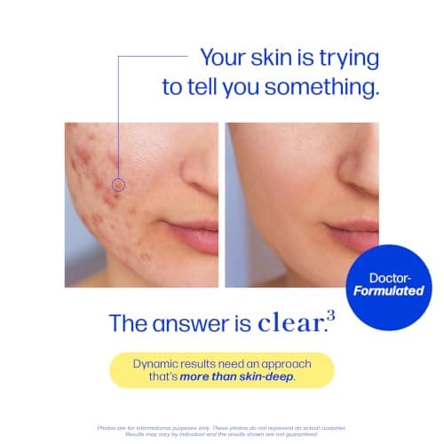 Clear Skin Supplement with Zinc, DIM & Probiotics | 3-in-1 Balance, Glow & Health Skin Support | Triple Action Hyaluronic Acid, Niaciminide & Vitamins for Hormone, Complexion & Gut Support | 60 Ct